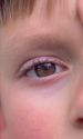 Close up image of a child's eye, eyebrow, eyelid, eyelash.  MR