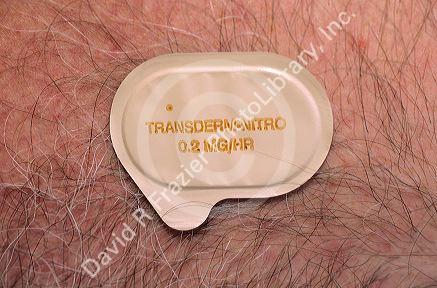 Nitroglycerine patch.